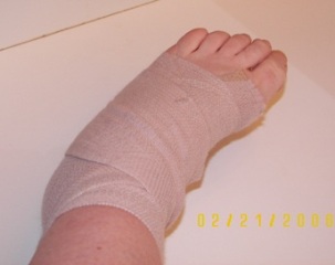 Taped Ankle